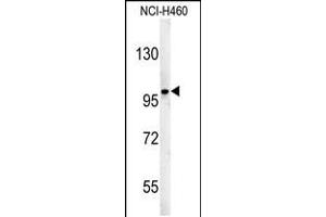 Western blot analysis in NCI-H460 cell line lysates (35ug/lane). (ST18 antibody  (N-Term))