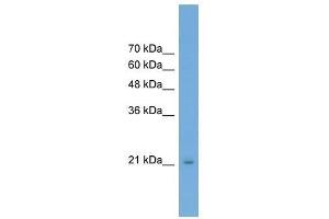 RAB25 antibody used at 0. (RAB25 antibody  (Middle Region))