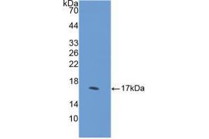 Western blot analysis of recombinant Human DHH. (desert Hedgehog antibody  (AA 241-383))