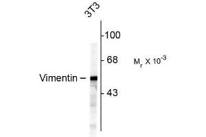 Image no. 1 for anti-Vimentin (VIM) antibody (ABIN372741) (Vimentin antibody)