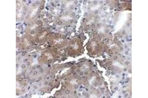 Immunohistochemistry of AP2M1 in mouse kidney tissue with AP2M1 antibody at 2. (AP2M1 antibody  (C-Term))