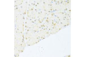 Immunohistochemistry of paraffin-embedded rat pancreas using NR1I2 antibody (ABIN5970763) at dilution of 1/100 (40x lens).