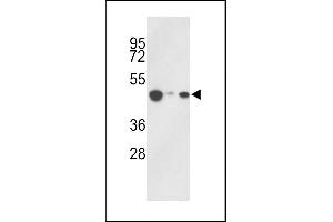 Western blot analysis of hHAT1- (ABIN387932 and ABIN2844437) in 293, HepG2, Jurkat cell line lysates (35 μg/lane). (HAT1 antibody  (C-Term))