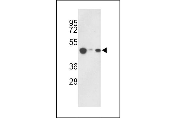 HAT1 Antikörper  (C-Term)