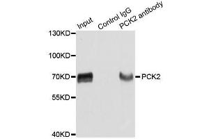 Immunoprecipitation analysis of extracts of HepG2 cells using PCK2 antibody. (PEPCK antibody  (AA 1-280))