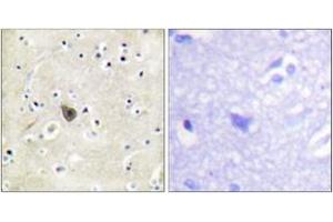 Immunohistochemistry analysis of paraffin-embedded human brain tissue, using PKD2 (Ab-876) Antibody. (PKD2 antibody  (AA 829-878))