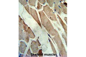 Formalin-fixed and paraffin-embedded human skeletal musclereacted with CKM polyclonal antibody , which was peroxidase-conjugated to the secondary antibody, followed by AEC staining. (CKM antibody  (C-Term))