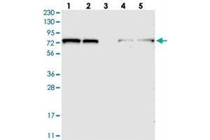 Western blot analysis of Lane 1: RT-4, Lane 2: U-251 MG, Lane 3: Human Plasma, Lane 4: Liver, Lane 5: Tonsil with TBC1D15 polyclonal antibody  at 1:250-1:500 dilution.