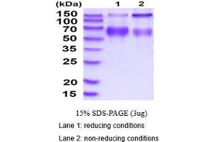 SDS-PAGE (SDS) image for Lysosomal-Associated Membrane Protein 2 (LAMP2) (AA 26-379) protein (His tag) (ABIN5854611)