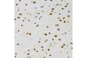 Immunohistochemistry of paraffin-embedded rat brain using CSRP3 Antibody (ABIN2562048) at dilution of 1:100 (40x lens). (CSRP3 antibody)