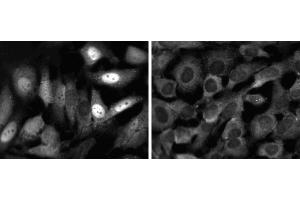 Immunofluorescent staining of HeLa (ATCC CCL-2) cells. (STAT1 antibody  (AA 592-731))