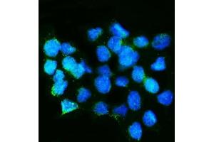 IF analysis of Calretinin/CALB2 using anti-Calretinin/CALB2 antibody (ABIN7603109). (Calretinin antibody  (AA 59-90))