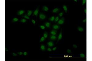 Immunofluorescence of monoclonal antibody to TRIM33 on HeLa cell. (TRIM33 antibody  (AA 1006-1105))