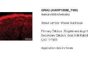Immunohistochemistry (IHC) image for anti-Glutamate Receptor, Ionotropic, AMPA 2 (GRIA2) (N-Term) antibody (ABIN184248) (GRIA2 antibody  (N-Term))