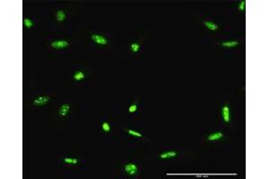 Immunofluorescence of purified MaxPab antibody to ADAR on HeLa cell. (ADAR antibody  (AA 1-1226))