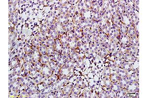 Formalin-fixed and paraffin embedded: rat kidney tissue labeled with Anti-GLUT4 Polyclonal Antibody (ABIN739445), Unconjugated at 1:200, followed by conjugation to the secondary antibody and DAB staining (GLUT4 antibody  (AA 401-509))