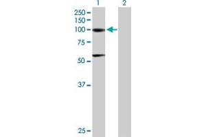 Western Blot analysis of ACO1 expression in transfected 293T cell line by ACO1 MaxPab polyclonal antibody. (Aconitase 1 antibody  (AA 1-889))