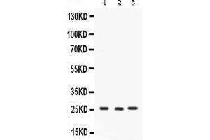 Western Blotting (WB) image for anti-Calcyclin Binding Protein (CACYBP) (AA 7-47), (N-Term) antibody (ABIN4886495)