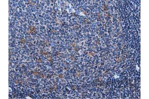 Immunohistochemical staining of paraffin-embedded Human lymph node tissue using anti-MICAL1 mouse monoclonal antibody.
