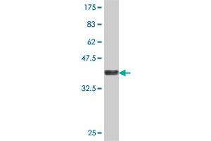 Western Blot detection against Immunogen (37 KDa) .