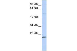 Human Jurkat; WB Suggested Anti-ZNF79 Antibody Titration: 0.
