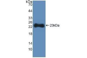 Detection of Recombinant HMGCS, Human using Polyclonal Antibody to Hydroxymethylglutaryl Coenzyme A Synthase (HMGCS) (HMGCS1 antibody  (AA 293-467))