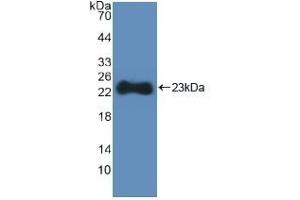 Detection of Recombinant HMGCS, Human using Polyclonal Antibody to Hydroxymethylglutaryl Coenzyme A Synthase (HMGCS)