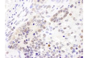 Immunohistochemistry (IHC) image for anti-Cullin 4B (CUL4B) (AA 863-913) antibody (ABIN7454566)