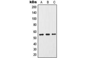 Western blot analysis of Cytochrome P450 2C9 expression in HeLa (A), Raw264. (CYP2C9 antibody  (Center))