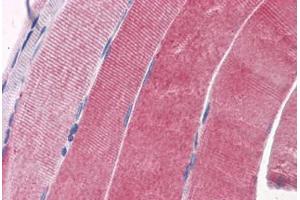 Human Skeletal muscle: Formalin-Fixed, Paraffin-Embedded (FFPE)