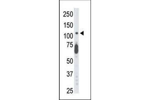 The anti-STK9 Pab is used in Western blot to detect STK9 in mouse lung tissue lysate.