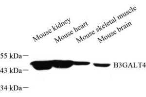 Western blot analysis of B3GALT4 (ABIN7076137) at dilution of 1: 500 (B3GALT4 antibody)