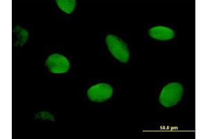 Immunofluorescence of purified MaxPab antibody to CHD2 on HeLa cell. (CHD2 antibody  (AA 1-501))