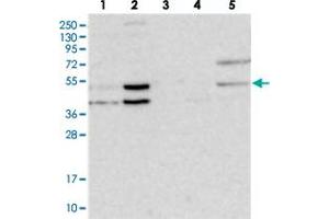Western blot analysis of Lane 1: RT-4, Lane 2: U-251 MG, Lane 3: Human Plasma, Lane 4: Liver, Lane 5: Tonsil with NSMCE4A polyclonal antibody  at 1:250-1:500 dilution. (NSMCE4A antibody)