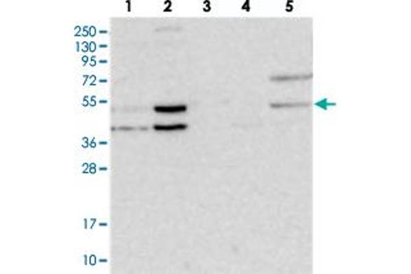 NSMCE4A antibody