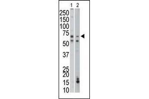 The anti-PCK1 Pab (ABIN1882180 and ABIN2842170) is used in Western blot to detect PCK1 in mouse liver (Lane 1) and mouse small intestine tissue lysates (Lane 2). (PCK1 antibody  (C-Term))