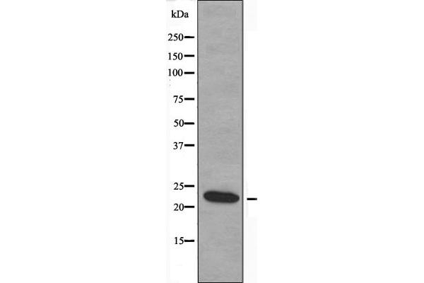 MOBKL2B antibody  (C-Term)