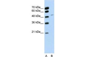 Western Blotting (WB) image for anti-RNA Binding Motif Protein 22 (RBM22) antibody (ABIN2462277) (RBM22 antibody)