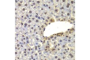 Immunohistochemistry of paraffin-embedded mouse liver using SUPT20H antibody (ABIN6133386, ABIN6148735, ABIN6148736 and ABIN6223233) at dilution of 1:100 (40x lens). (FAM48A/P38IP antibody  (AA 580-779))