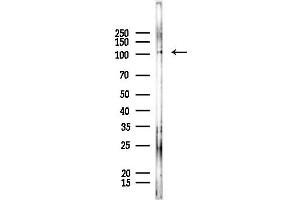 Western blot analysis of lysates from  cells, using FBXO11 Antibody at 1/1000 dilution.