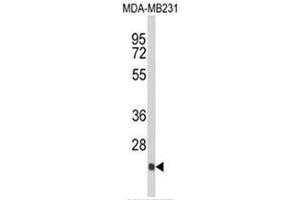 Western blot analysis of DERL2 Antibody (C-term) in MDA-MB231 cell line lysates (35ug/lane). (Der1-Like Domain Family, Member 2 (DERL2) (C-Term) antibody)