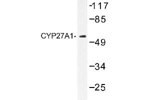 Image no. 1 for anti-Cytochrome P450, Family 27, Subfamily A, Polypeptide 1 (CYP27A1) antibody (ABIN272272) (CYP27A1 antibody)