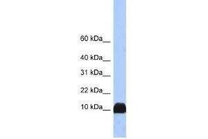 Profilin 1 antibody used at 1 ug/ml to detect target protein.