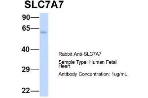 Host:  Rabbit  Target Name:  SLC7A7  Sample Type:  Human Fetal Heart  Antibody Dilution:  1. (SLC7A7 antibody  (Middle Region))