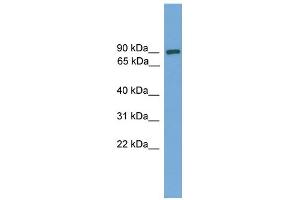 WB Suggested Anti-DEPDC1 Antibody Titration: 0.