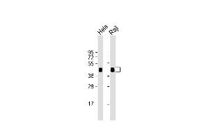 Western Blot at 1:1000 dilution Lane 1: Hela whole cell lysate Lane 2: Raji whole cell lysate Lysates/proteins at 20 ug per lane.