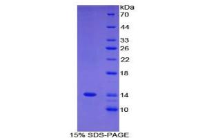 SDS-PAGE analysis of Human FAM19A3 Protein. (FAM19A3 Protein)