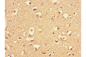 Immunohistochemistry of paraffin-embedded human brain tissue using ABIN7145523 at dilution of 1:100 (Nerve Growth Factor antibody  (AA 122-218))