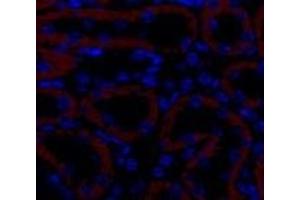 Immunofluorescence analysis of Mouse kidney tissue using TGF β Receptor II Polyclonal Antibody at dilution of 1:200. (TGFBR2 antibody)