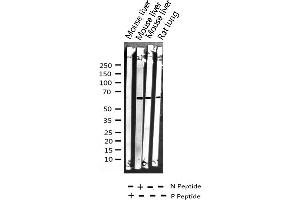 Western blot analysis of Phospho-HDAC1 (Ser421) expression in various lysates (HDAC1 antibody  (pSer421))